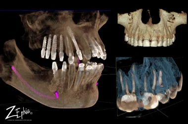 imágenes dentales digitales para modelos