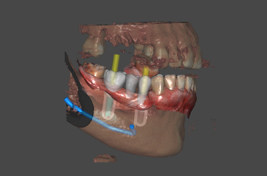 centro radiología oral en Bogotá: radiografías dentales 2D y 3D
