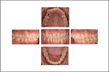 Imágenes dentales digitales intraorales y extraorales en Bogotá