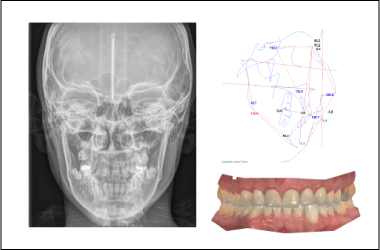 centro radiología oral en Bogotá: Tomografía dental, Rx Panorámica oral