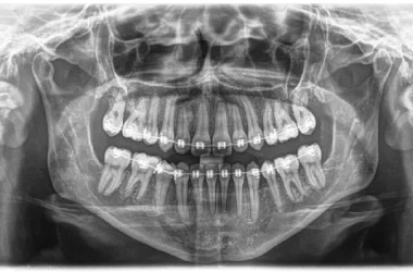 radiografía panorámica dental estándar en Bogotá