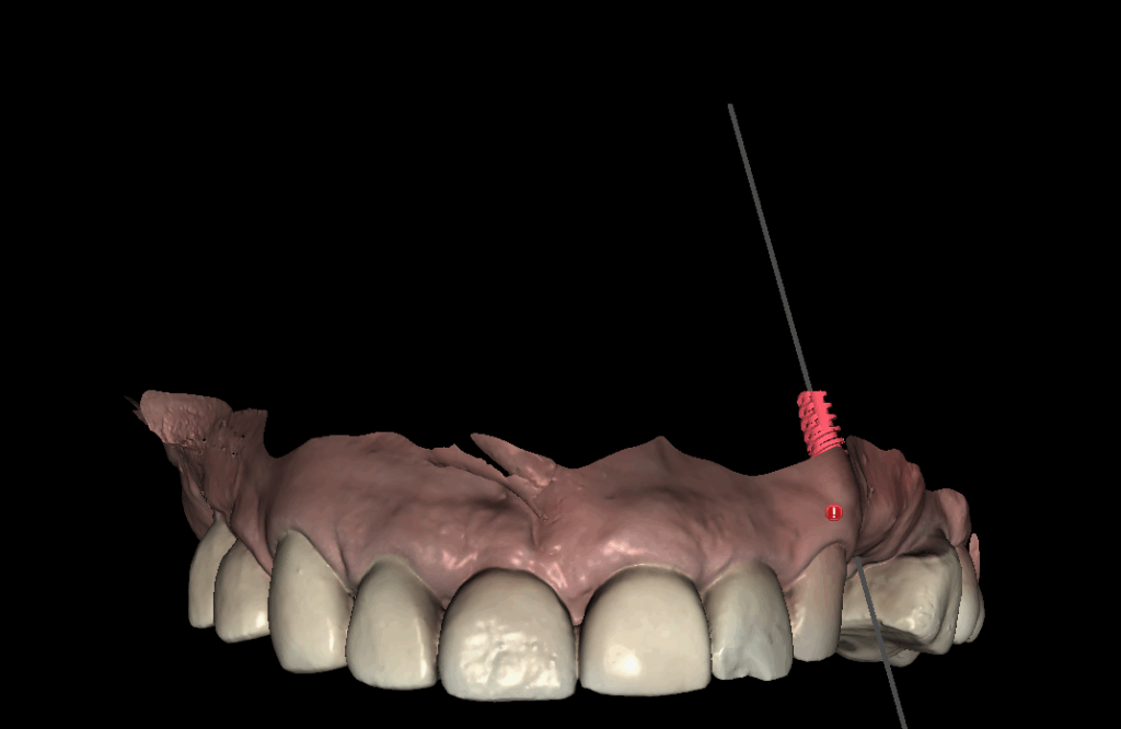modelo digital dental